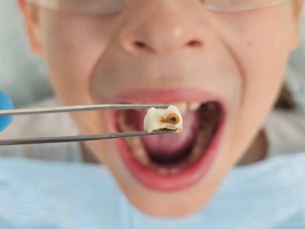 Best Emergency Pediatric Dentist  in Tuckahoe, VA