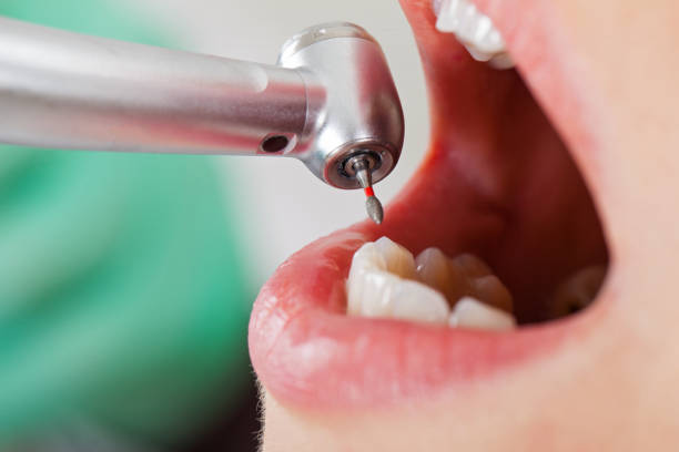 Best Tooth Infection Emergency Dentist  in Tuckahoe, VA